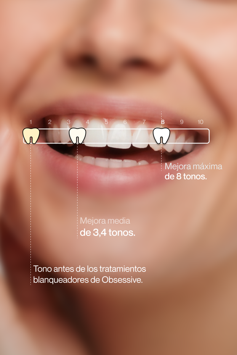 PURPLE V34 - Teeth Whitening