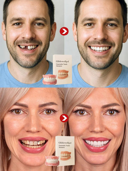 🦷【 Epic Upgrade】Premium Full Cover Dentures 🦷
