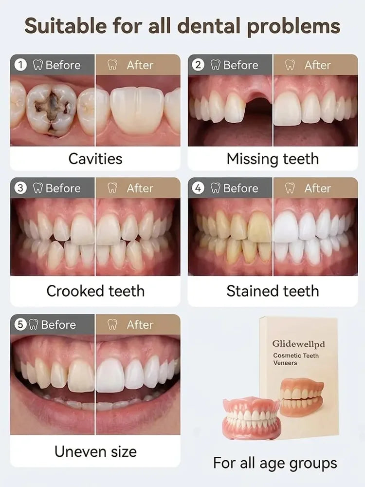🦷【 Epic Upgrade】Premium Full Cover Dentures 🦷
