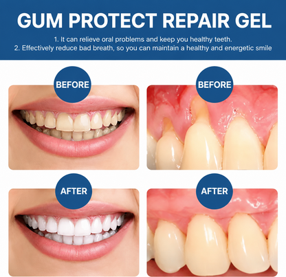 Mirarepair™ Teeth Repair Gel