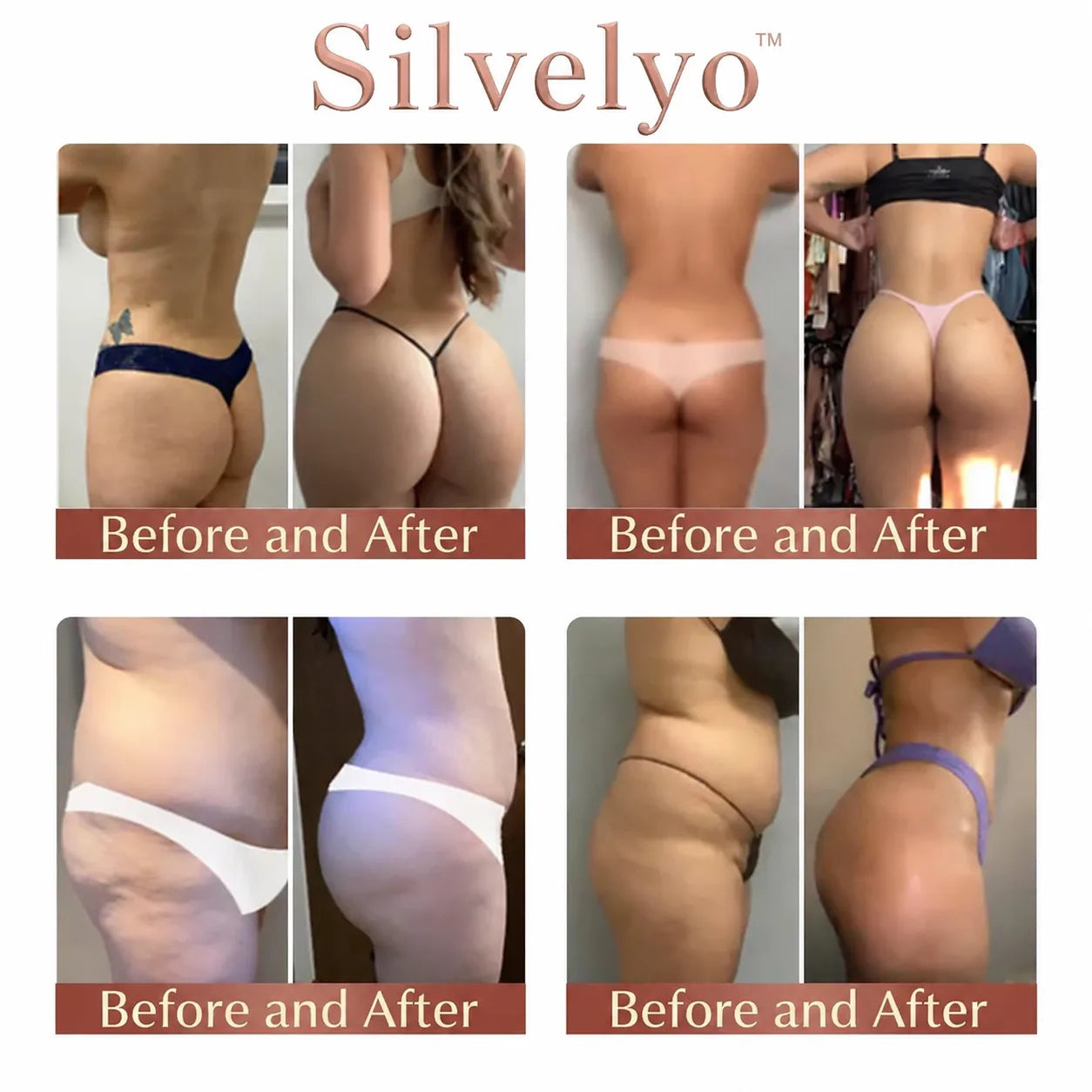 Silvelyo™ CurveSculpt Micro-Patch ✦ Sculpt • Firm • Smooth Lower Body Curves ✦ Micro-Needle Infusion System
