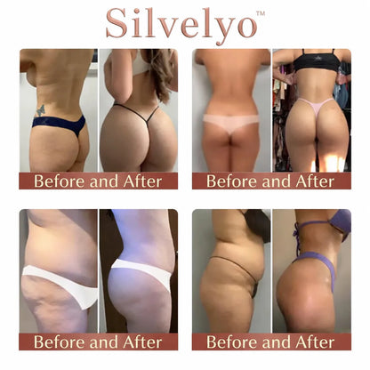 Silvelyo™ CurveSculpt Micro-Patch ✦ Sculpt • Firm • Smooth Lower Body Curves ✦ Micro-Needle Infusion System