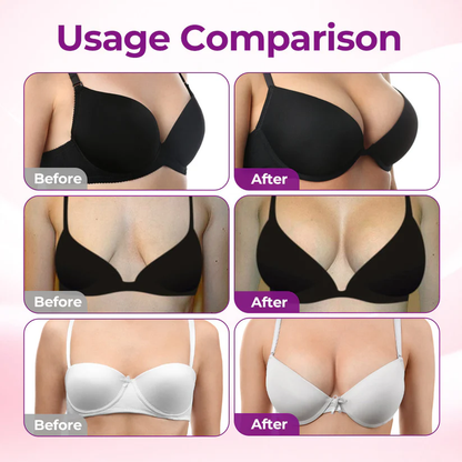 💥Targeted Breast Enhancement Advanced Nano Microneedle Patch