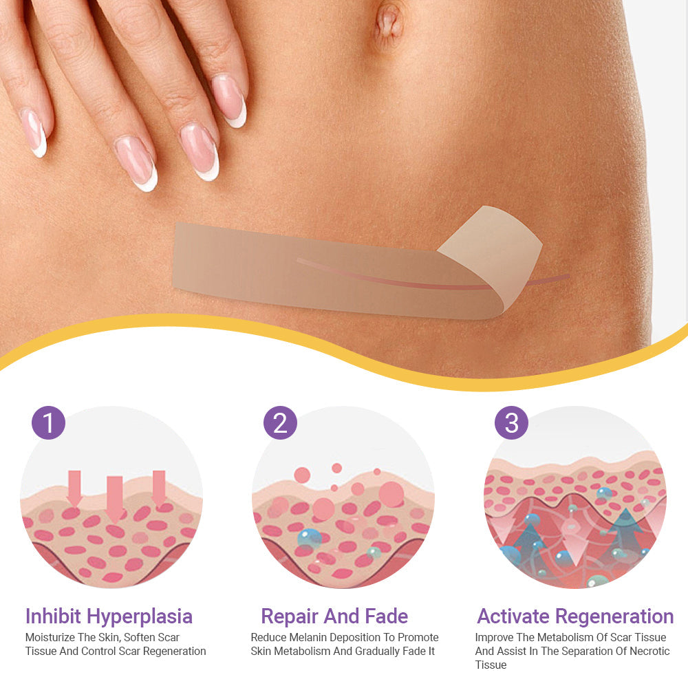 ✅GFOUK® Hyaluronic Acid Nano Microneedle Repair Tape🦘👨‍⚕️