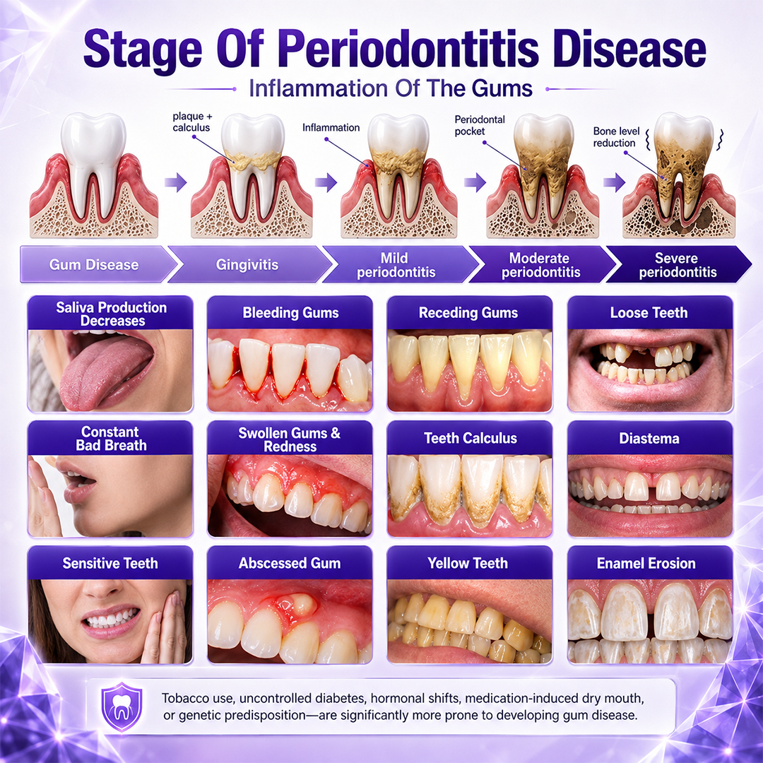 🦷Ceoerty® Gingivitis Periodontal Treatment Toothpaste🏆✨