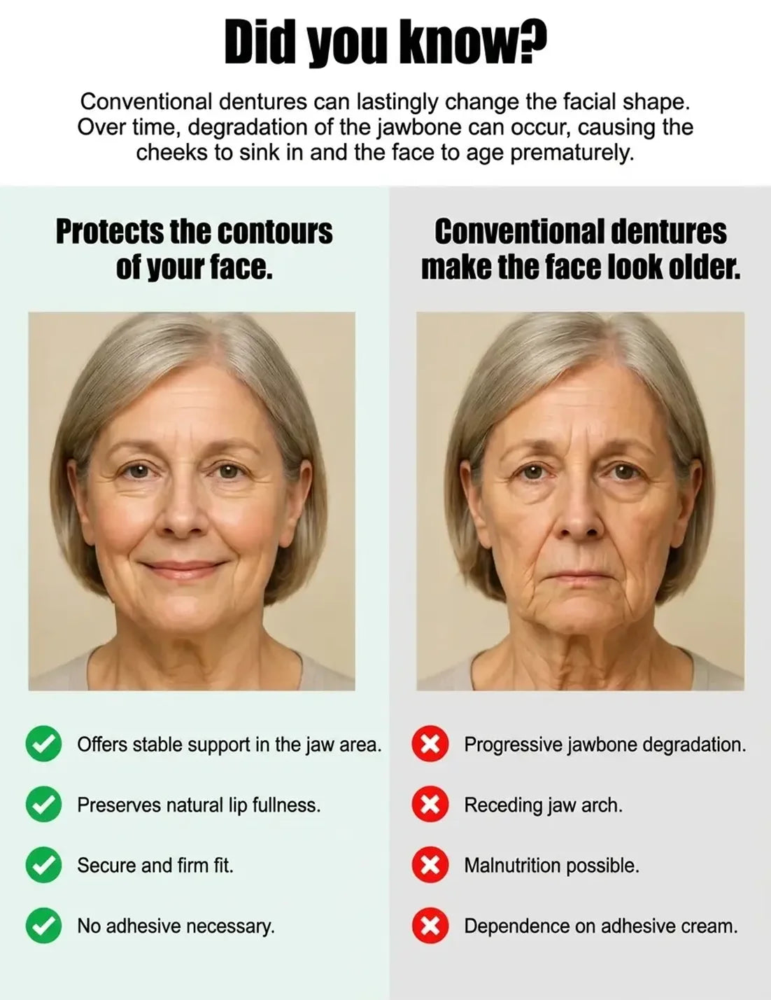 German Medical-Grade Snap-In Full Dentures