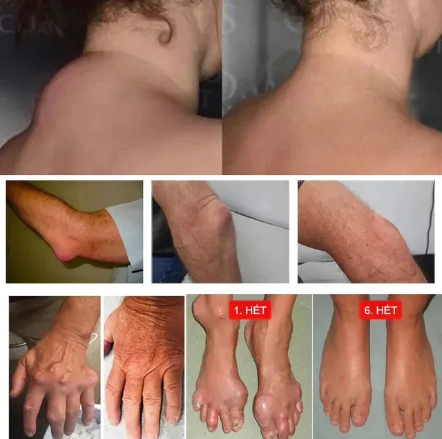 Miaojiang muscle relaxant and pain reliever