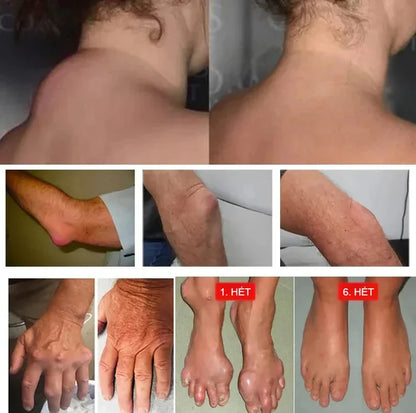 Miaojiang muscle relaxant and pain reliever