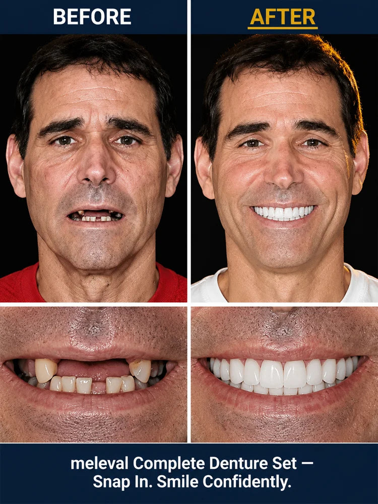 🦷 Premium Complete Denture Set