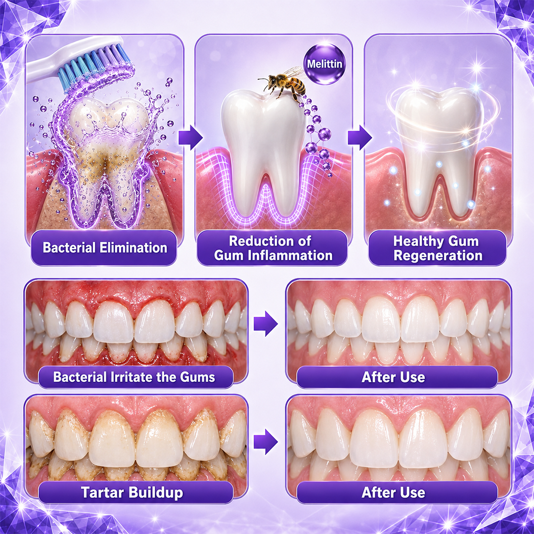 🦷Ceoerty® Gingivitis Periodontal Treatment Toothpaste🏆✨