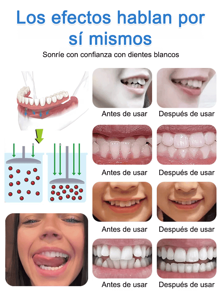 🔥Gran Oferta -📢Juego de prótesis dentales funcionales completas