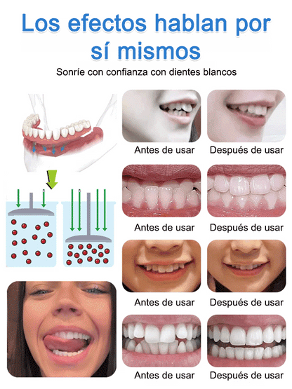 🔥Gran Oferta -📢Juego de prótesis dentales funcionales completas