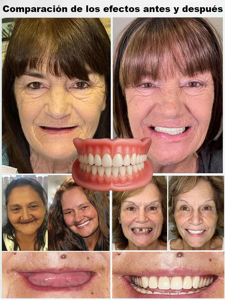 🦷✨ Estuche dental portátil con prótesis: Recupera tu sonrisa