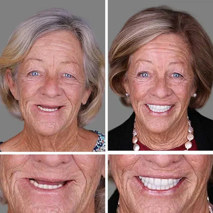 🦷 Ends Today: 50% OFF! ⏰ Medical Full Denture with Strong Suction