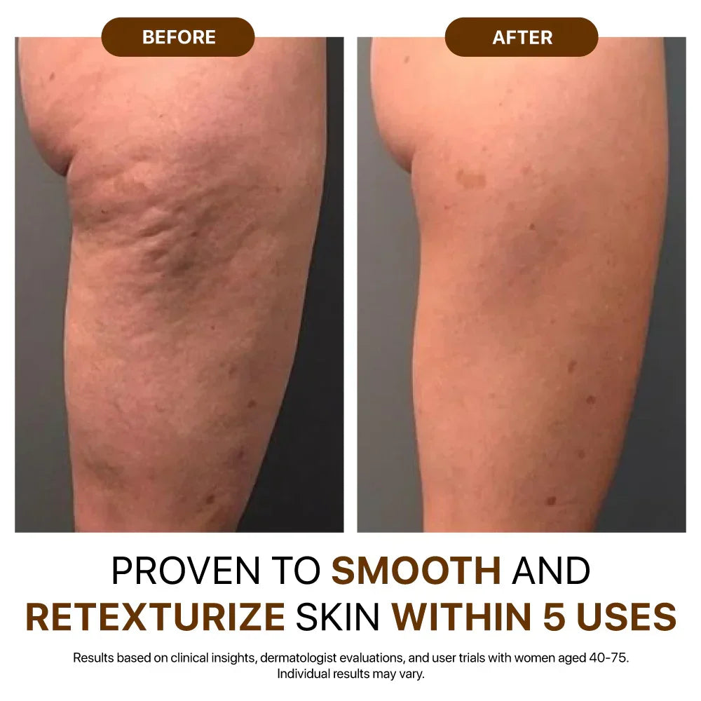 Rediscover confidence with firmer, smoother, radiant skin🎁Goda® Silk Body Oil