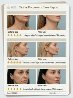 🔥【10-Year Rejuvenation】A cream infused with collagen and fullerene to promote cell regeneration.