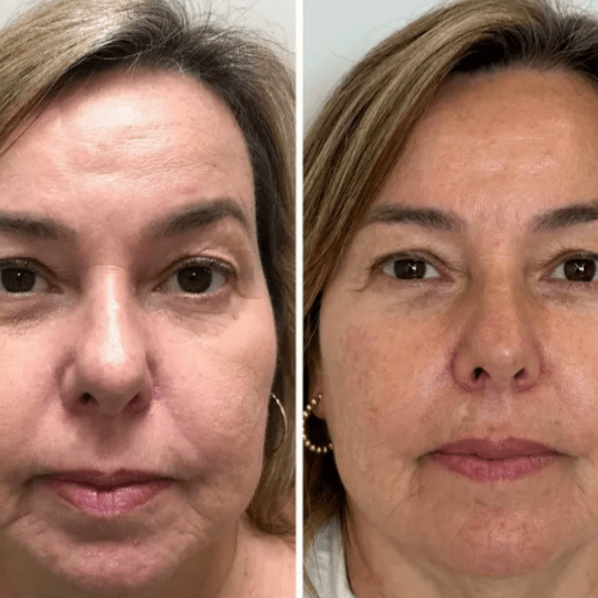 Mascarilla coreana rejuvenecedora de colágeno Peel Off - Collagen Fit™