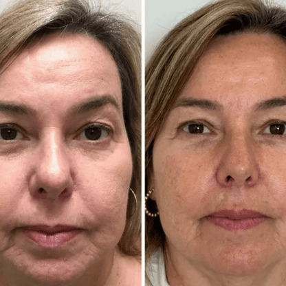 Mascarilla coreana rejuvenecedora de colágeno Peel Off - Collagen Fit™