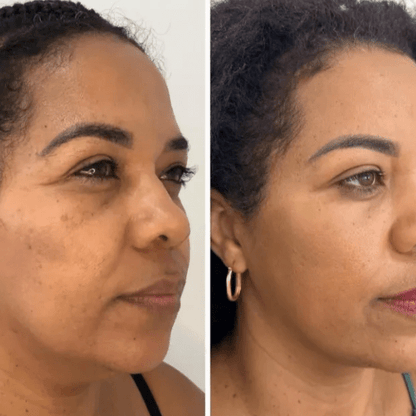 Mascarilla coreana rejuvenecedora de colágeno Peel Off - Collagen Fit™