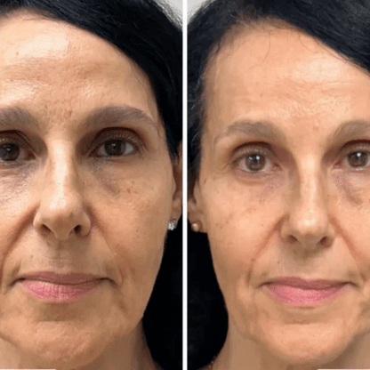 Mascarilla coreana rejuvenecedora de colágeno Peel Off - Collagen Fit™