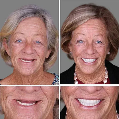 🌎 Ends Today: 50% OFF! ⏰ Medical Full Denture with Strong Suction