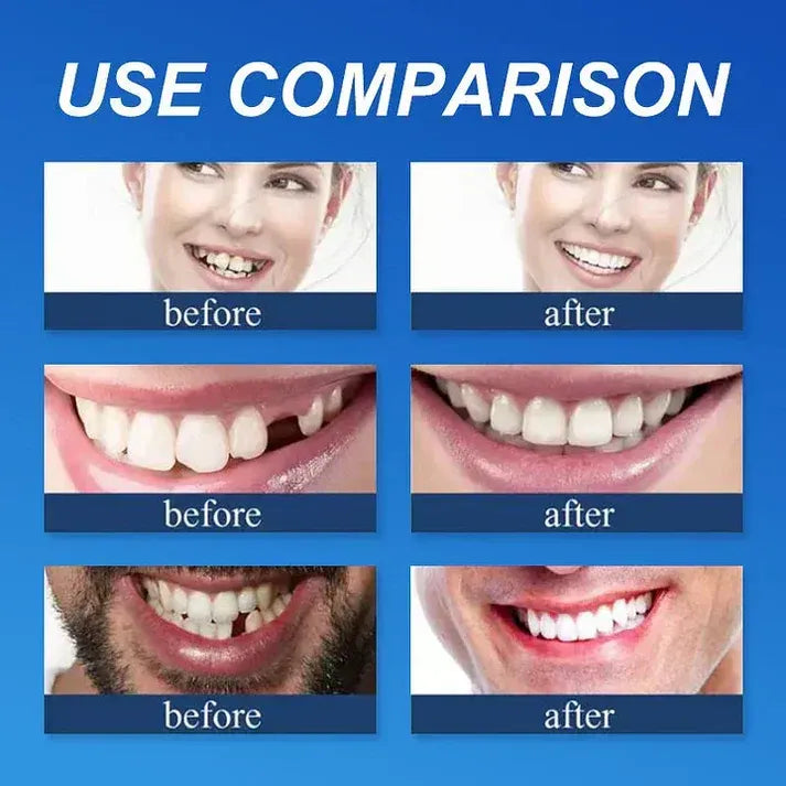 🌎 Ends Today: 50% OFF! ⏰ Medical Full Denture with Strong Suction