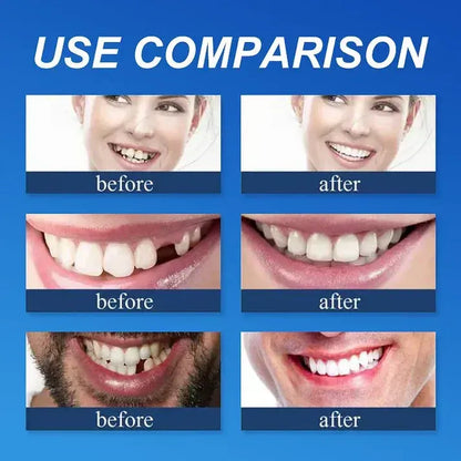 🌎 Ends Today: 50% OFF! ⏰ Medical Full Denture with Strong Suction