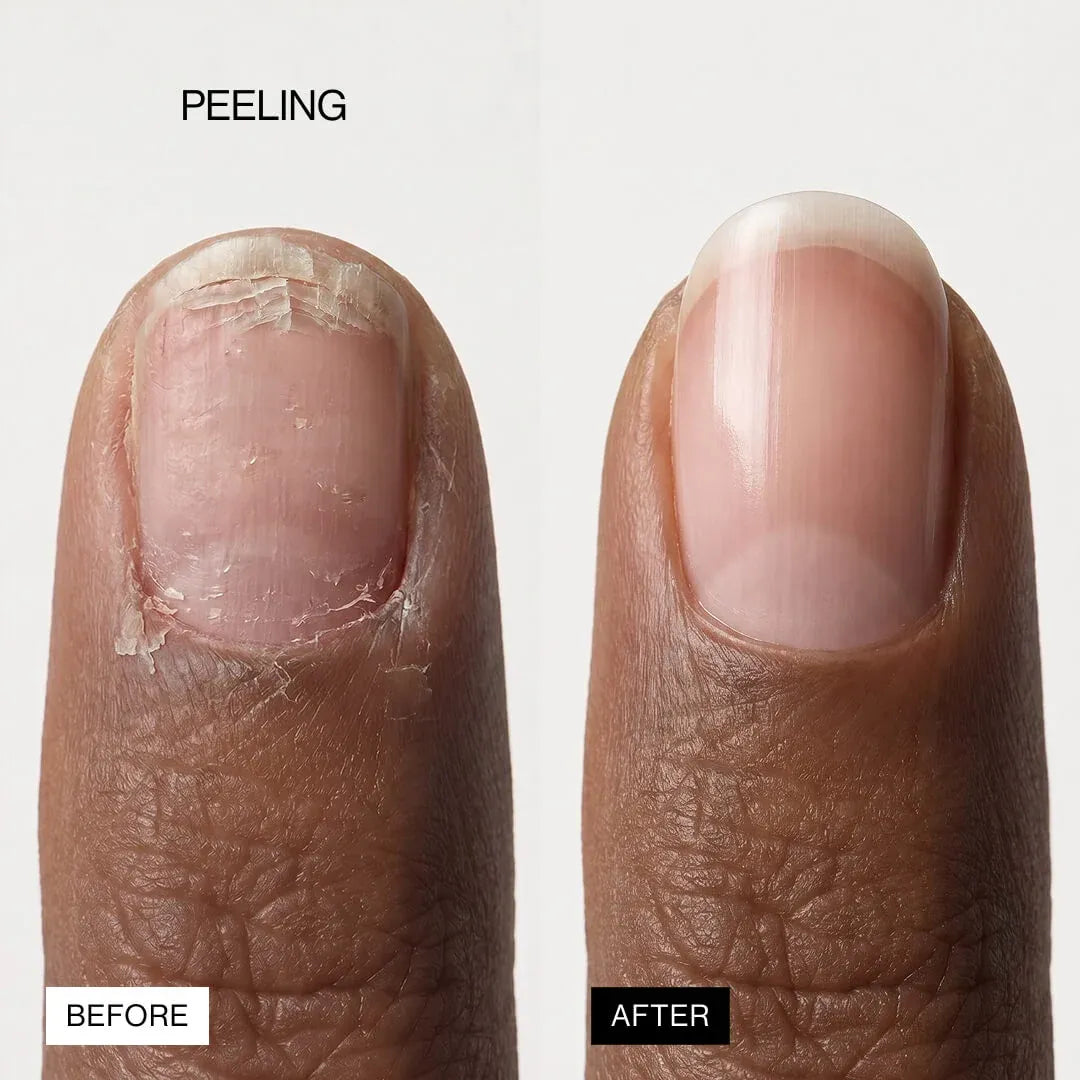 LIPIFIL-3 COMPLEX™ NAIL GROWTH SERUM