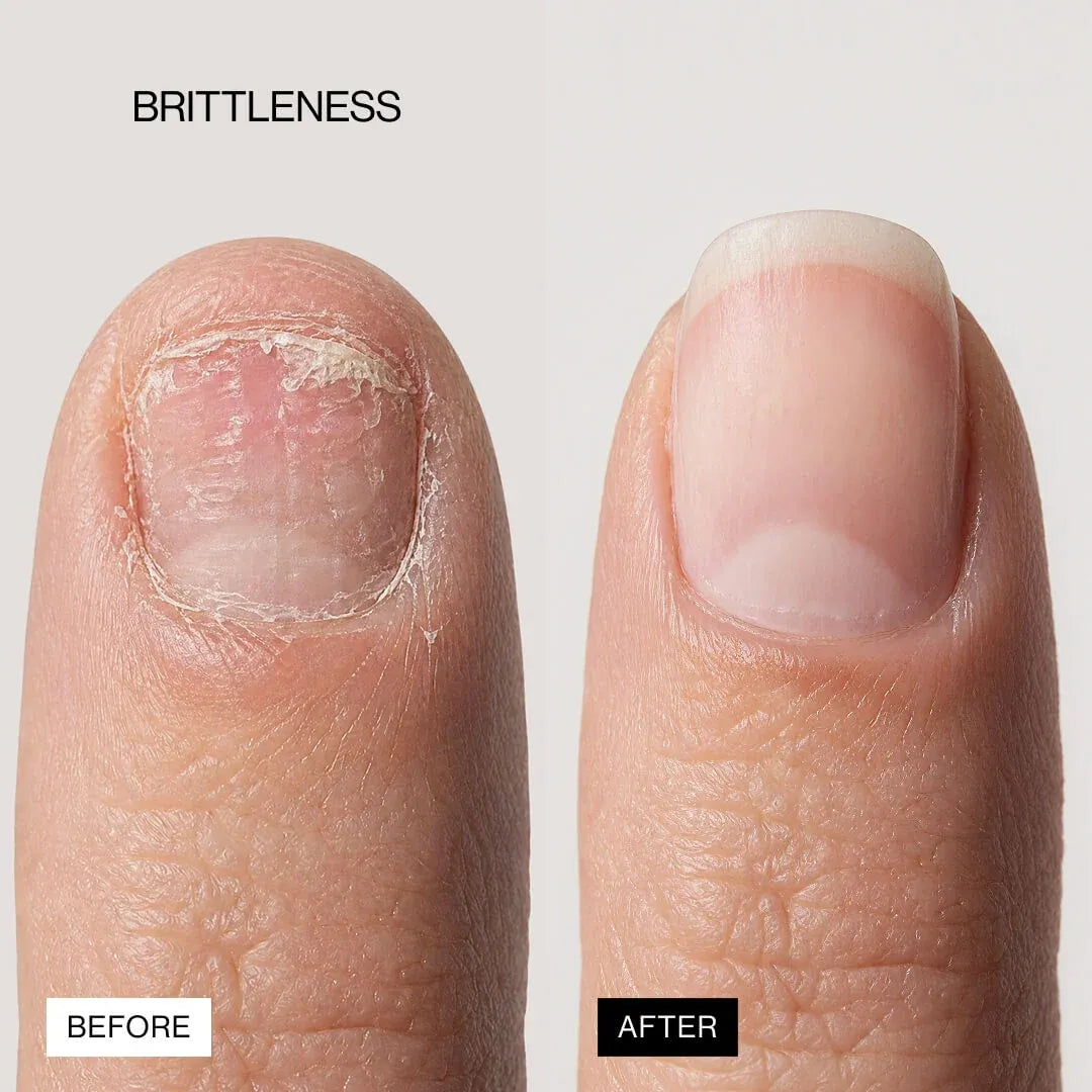LIPIFIL-3 COMPLEX™ NAIL GROWTH SERUM