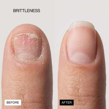 LIPIFIL-3 COMPLEX™ NAIL GROWTH SERUM