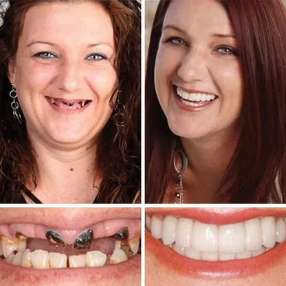 🌎 Ends Today: 50% OFF! ⏰ Medical Full Denture with Strong Suction