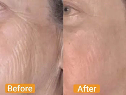 Look Up to 10 Years Younger in Just 10 Seconds!