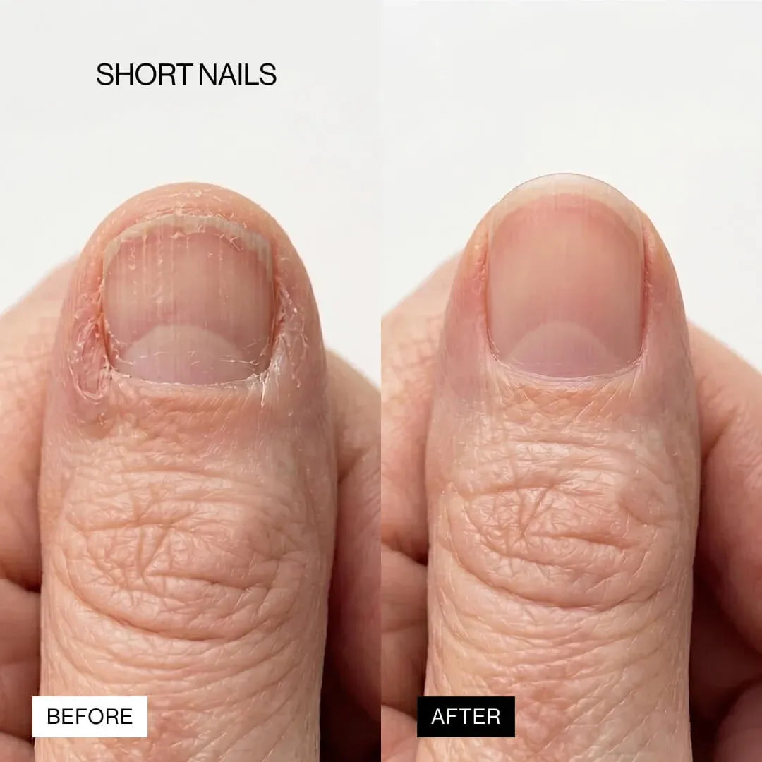 LIPIFIL-3 COMPLEX™ NAIL GROWTH SERUM