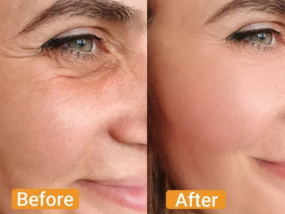 Look Up to 10 Years Younger in Just 10 Seconds!