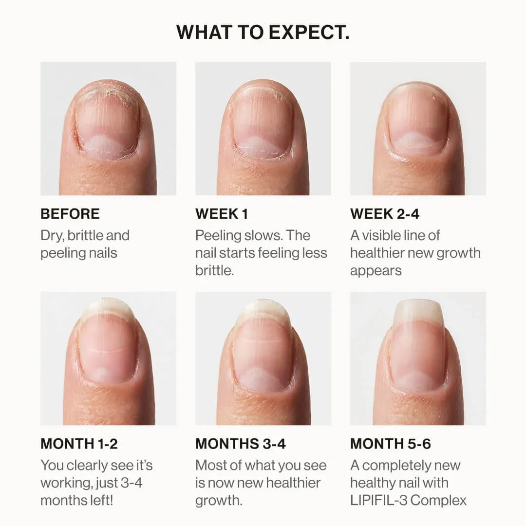 LIPIFIL-3 COMPLEX™ NAIL GROWTH SERUM