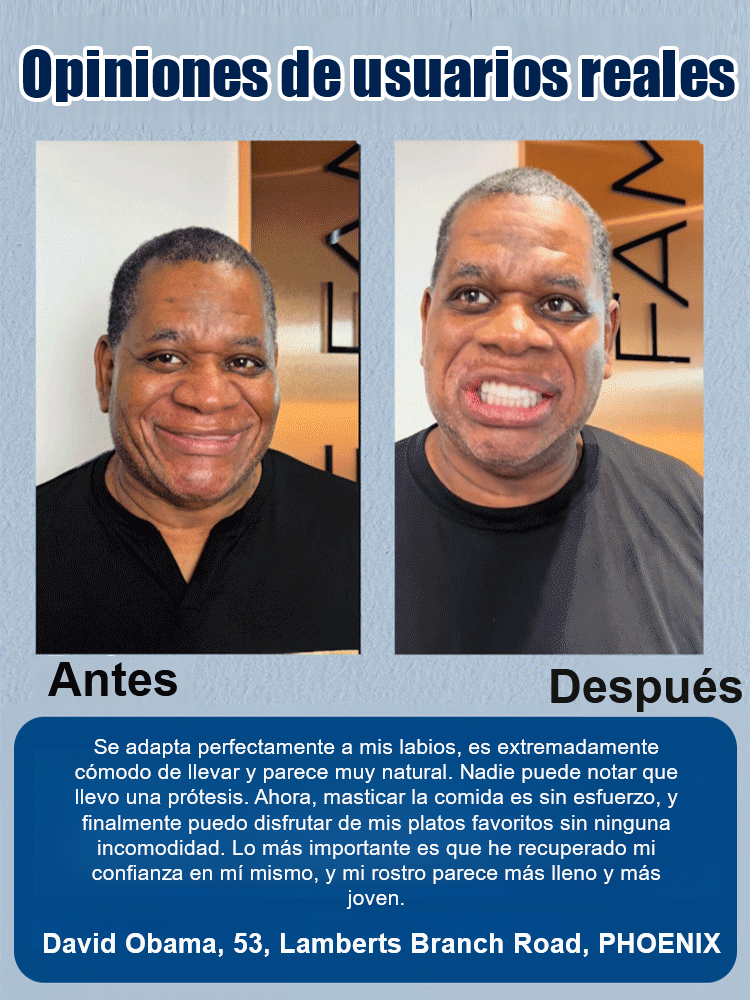 🎭✨ ¡Transforma tu look en segundos!🦷DIYCOS Dentaduras postizas para maquillaje de escenario💄