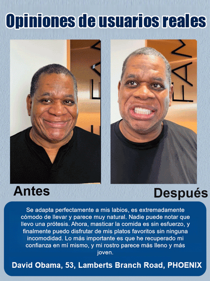 🎭✨ ¡Transforma tu look en segundos!🦷DIYCOS Dentaduras postizas para maquillaje de escenario💄