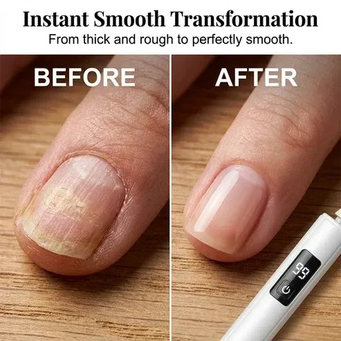 🥳Professional Electric Nail Polisher – Smooths thick nails, 99-speed display. Multiple heads for shaping & buffing. Salon at home! 🌟💎