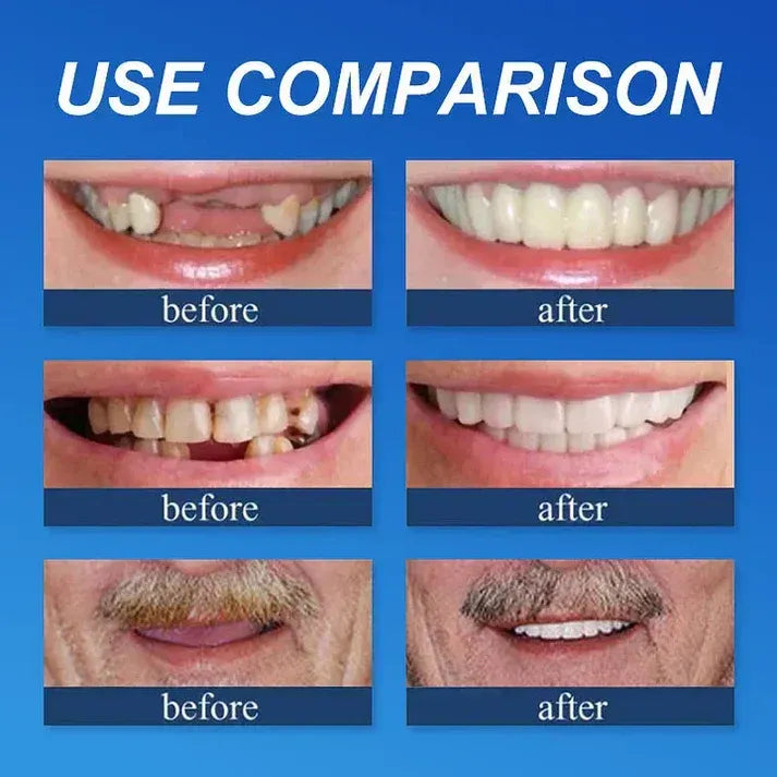 🌎 Ends Today: 50% OFF! ⏰ Medical Full Denture with Strong Suction