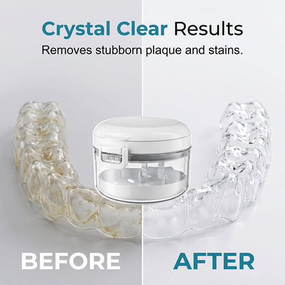 📢📢 50% OFF !! ⏰ All-in-One Retainer Storage Case – Keep Your Retainer Clean, Safe & Hygienic – Perfect for Home, Travel & On-the-Go ✨